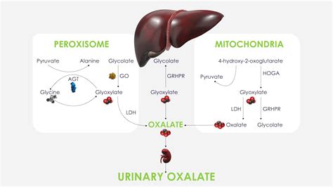 About Primary Hyperoxaluria Type 1 (PH1) .